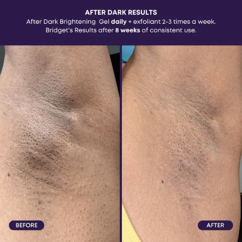 Bushbalm After Dark Brightening Gel