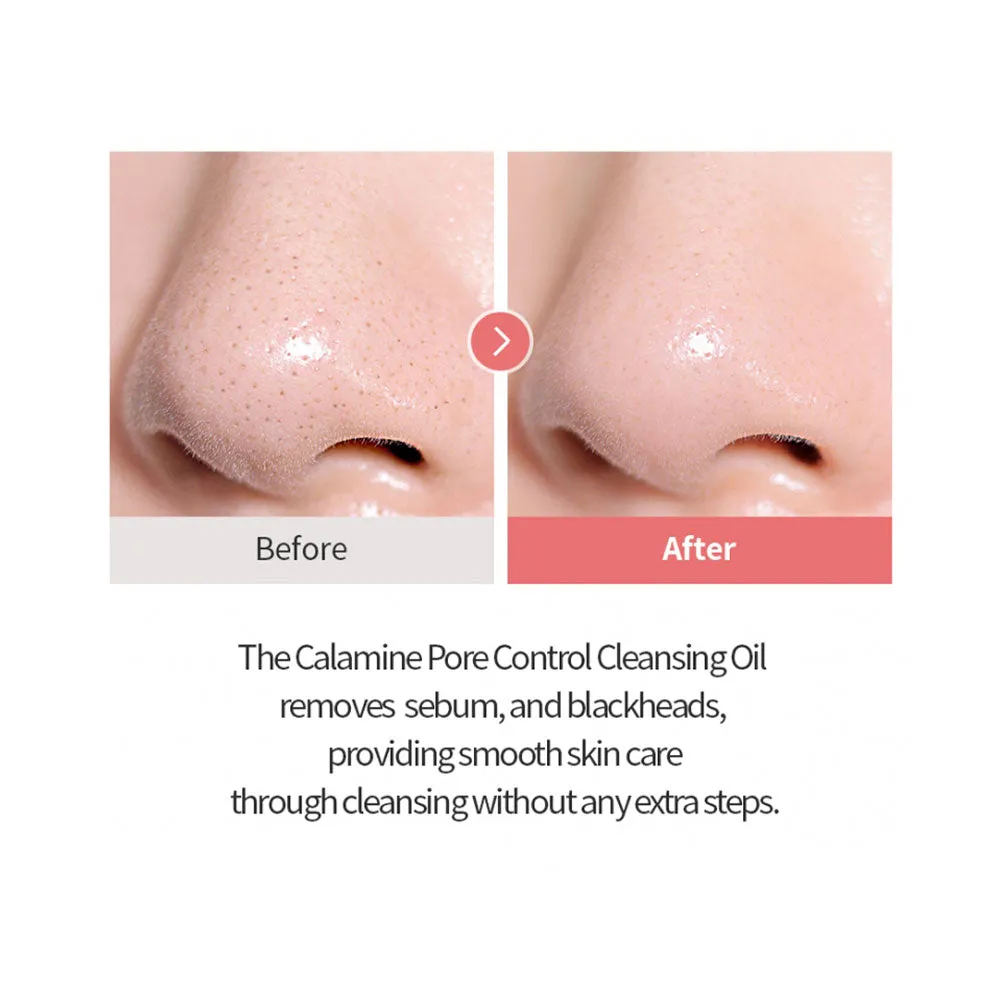 Calamine Pore Control Cleansing Oil