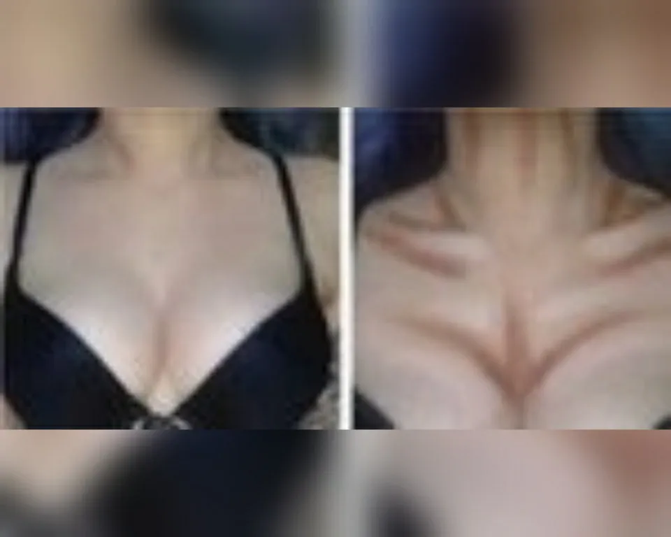 Exotoo Contour Stick