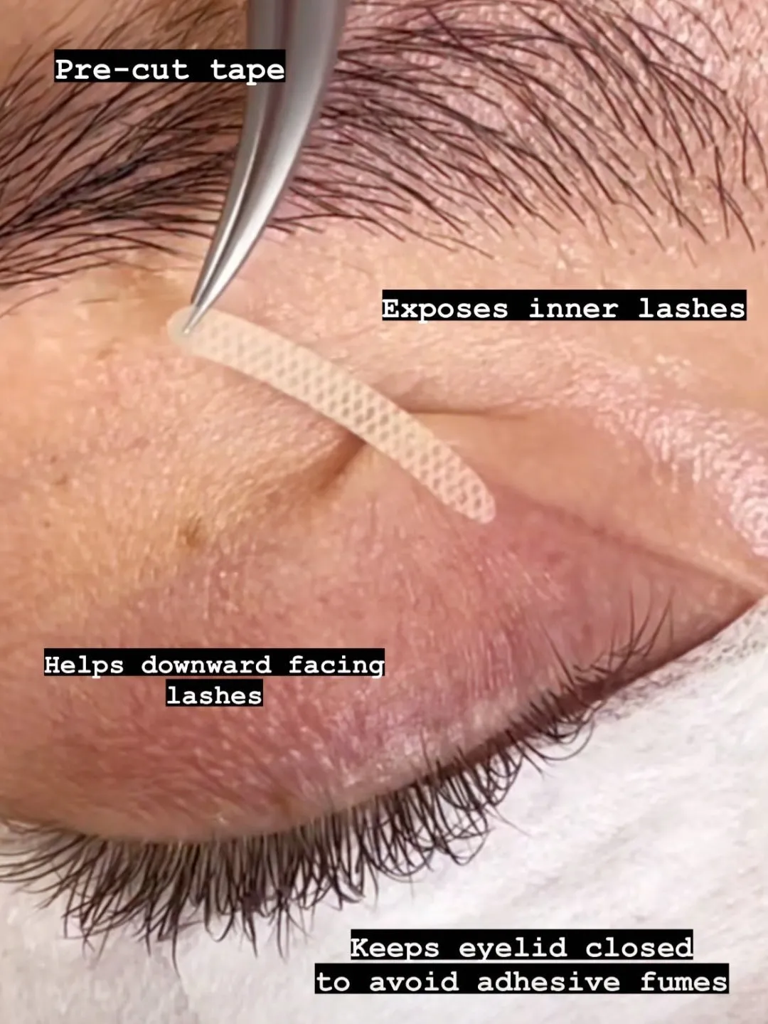 Eyelid Tape
