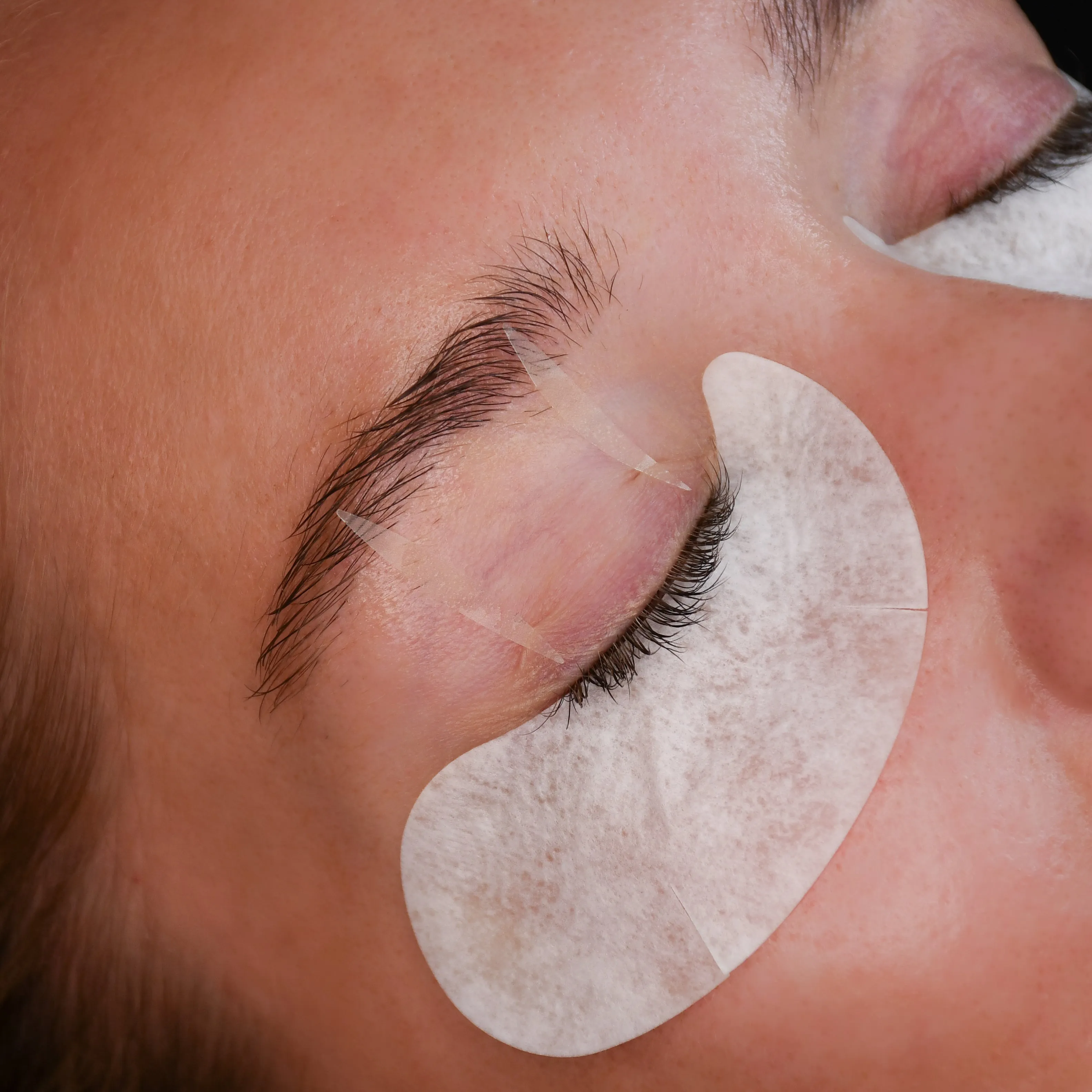 Eyelid Tape