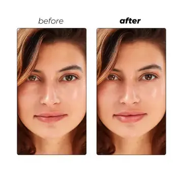 Instant Lip Filler Micro-Dart Patch