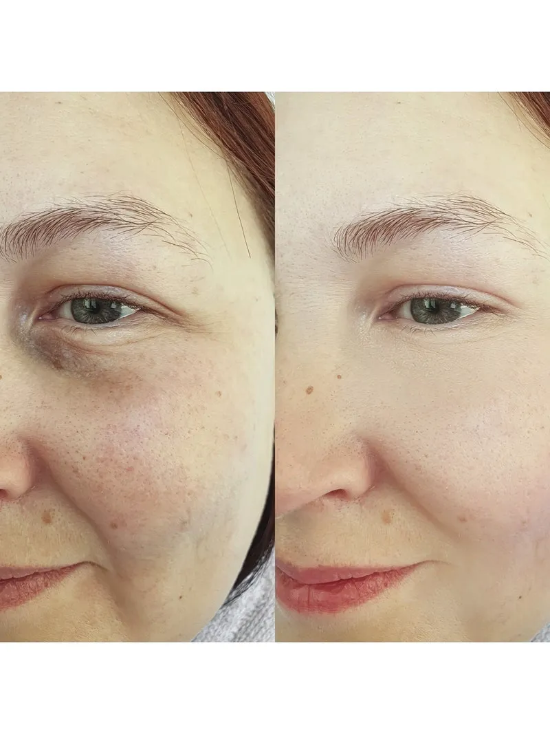 Natural Calming Yellow Corrective Concealer